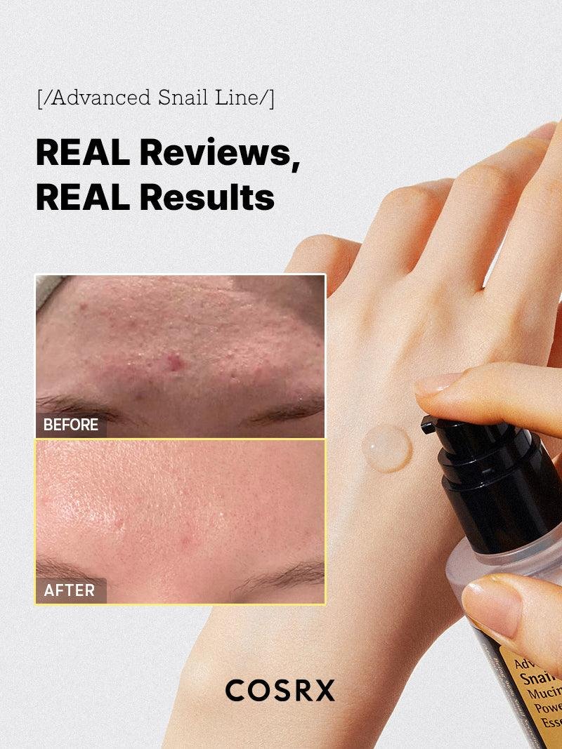 COSRX- Advanced Snail 96 mucin essence- 100ml - Imagen 3